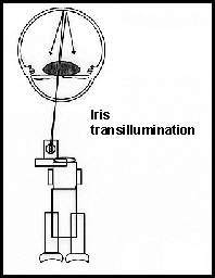 Illus4